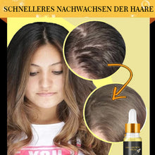 Laden Sie das Bild in den Galerie-Viewer, Biotin verdickende Kräuterextrakte