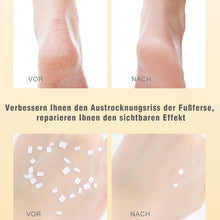 Laden Sie das Bild in den Galerie-Viewer, Fersenfrostschutz Antirissreparatur feuchtigkeitsspendendes Pflegeöl