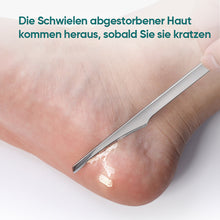 Laden Sie das Bild in den Galerie-Viewer, Fußschaber Pediküre-Werkzeug