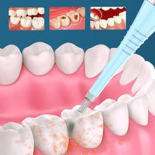 Laden Sie das Bild in den Galerie-Viewer, Elektrischer Zahnsteinentferner für Zahnstein