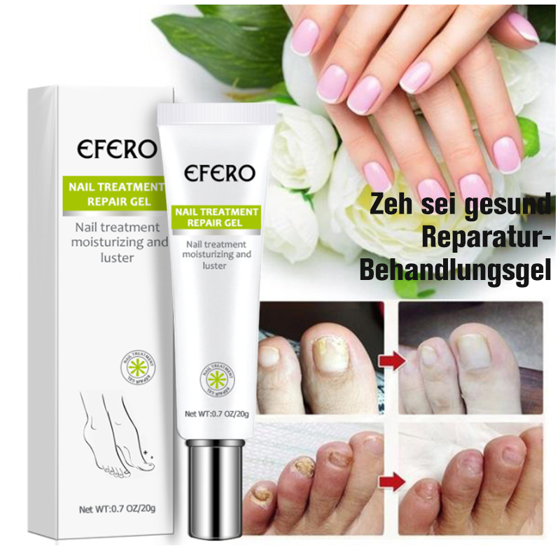 Creme zur Reparatur von Onychomykose