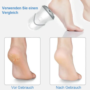 Elektrischer Fußschleifer