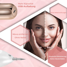 Laden Sie das Bild in den Galerie-Viewer, Elektrisches Schönheitsgerät zur Entfernung von Muttermalen