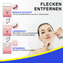 Laden Sie das Bild in den Galerie-Viewer, Feuchtigkeitscreme zur Fleckenentfernung