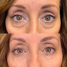 Laden Sie das Bild in den Galerie-Viewer, Wunderbare Anti-Aging-Augencreme