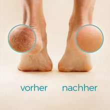 Laden Sie das Bild in den Galerie-Viewer, Fußschaber Pediküre-Werkzeug