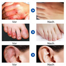 Laden Sie das Bild in den Galerie-Viewer, Spezielle Feuchtigkeitscreme mit Rissschutz
