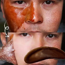 Laden Sie das Bild in den Galerie-Viewer, Mitesser-Maskencreme entfernen--abreißen kann