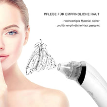 Laden Sie das Bild in den Galerie-Viewer, Elektrischer Mitesserentferner