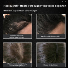 Laden Sie das Bild in den Galerie-Viewer, Haarnährlösung gegen Haarausfall mit Kugelmassage