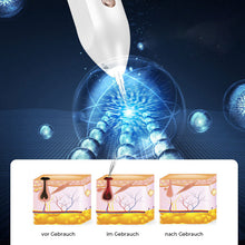 Laden Sie das Bild in den Galerie-Viewer, Elektrisches Schönheitsgerät zur Entfernung von Muttermalen