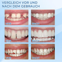 Laden Sie das Bild in den Galerie-Viewer, Fester Zahnrestauration-Kleber
