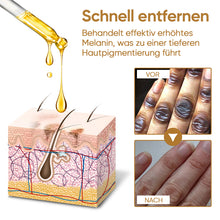 Laden Sie das Bild in den Galerie-Viewer, Melanin aufhellende Essenz