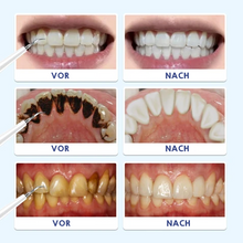 Laden Sie das Bild in den Galerie-Viewer, Elektrische Zahnbürste Zahnsteinentferner Set