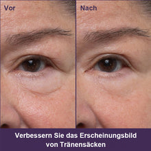 Laden Sie das Bild in den Galerie-Viewer, Wunderbare Anti-Aging-Augencreme