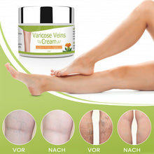 Laden Sie das Bild in den Galerie-Viewer, Creme Zur Reparatur Von Krampfadern