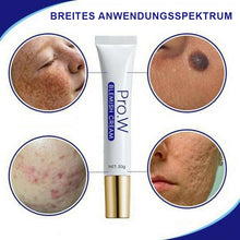 Laden Sie das Bild in den Galerie-Viewer, Feuchtigkeitscreme zur Fleckenentfernung