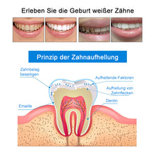 Laden Sie das Bild in den Galerie-Viewer, Zahnreinigungs- und Aufhellungsstift