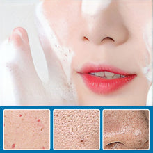 Laden Sie das Bild in den Galerie-Viewer, Reinigungsessenz mit kleinen Blasen (10 Stück)