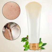 Laden Sie das Bild in den Galerie-Viewer, Mitesser-Entferner-Maske