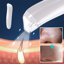 Laden Sie das Bild in den Galerie-Viewer, Mitesser-Reinigungsgerät
