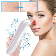 Laden Sie das Bild in den Galerie-Viewer, Mitesser-Reinigungsgerät